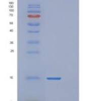 人线粒体核糖体蛋白L2(MRPL2)重组蛋白
