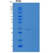 人线粒体核糖体蛋白L48(MRPL48)重组蛋白