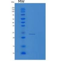 人线粒体核糖体蛋白L48(MRPL48)重组蛋白