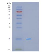 人MCFD2重组蛋白