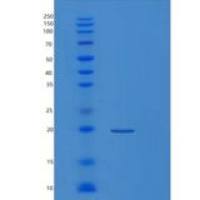 人巨噬细胞集落刺激因子(MCSF)重组蛋白