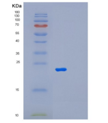 人微纤丝关联蛋白2(MFAP2)重组蛋白
