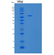 人基质金属蛋白酶14(MMP14)重组蛋白