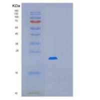 大肠杆菌mug重组蛋白