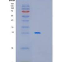 人MED20重组蛋白