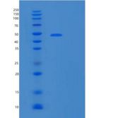 人基质金属蛋白酶28(MMP28)重组蛋白