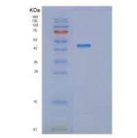 人MTHFSD重组蛋白