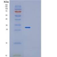 人调停蛋白复合体亚基4(MED4)重组蛋白