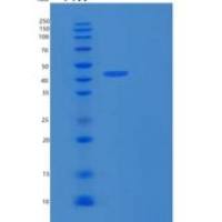 人基质金属蛋白酶1(MMP1)重组蛋白