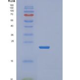 人线粒体核糖体蛋白L13(MRPL13)重组蛋白