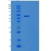 人髓细胞核分化抗原(MNDA)重组蛋白
