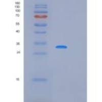 人微纤丝关联蛋白4(MFAP4)重组蛋白