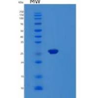 人MOB3B重组蛋白