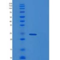 人O-6-甲基鸟嘌呤DNA甲基转移酶(MGMT)重组蛋白