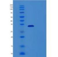人N-甲基嘌呤DNA糖基化酶(MPG)重组蛋白