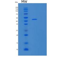 人基质金属蛋白酶13(MMP13)重组蛋白