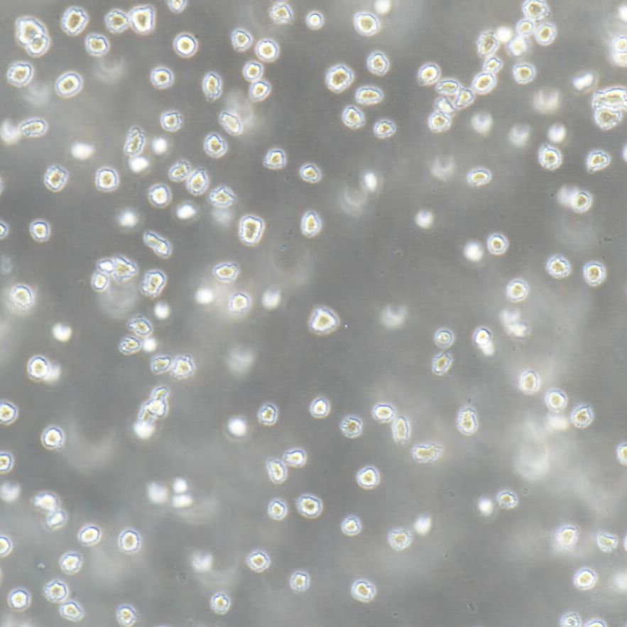 NALM-6 人B淋巴白血病细胞/STR鉴定/镜像绮点（Cellverse）