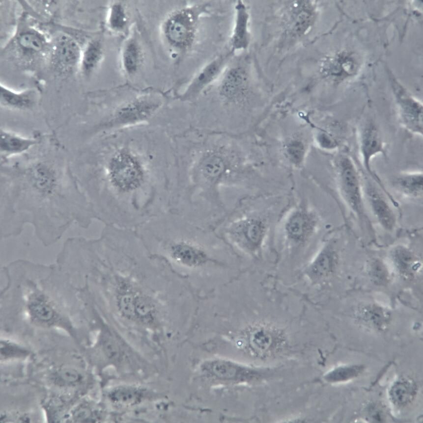 HLEC人淋巴内皮细胞永生化