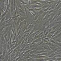 人原代主动脉瓣膜间质细胞永生化