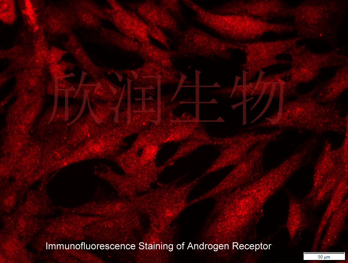 HDPCs细胞、DPC细胞、HDPC细胞、人毛乳头细胞系、永