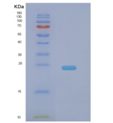 人NDUFB9重组蛋白