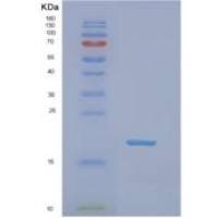 大鼠非转移细胞2表达NM23A蛋白(NME2)重组蛋白