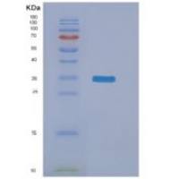 大肠杆菌nanA重组蛋白