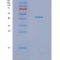 人NADH脱氢酶【泛醌】铁硫蛋白2，线粒体（NDUFS2）重组蛋白