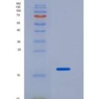 人神经营养因子4(NT4)重组蛋白