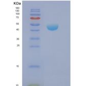 人酪氨酸激酶衔接蛋白非催化区2(NCK2)重组蛋白
