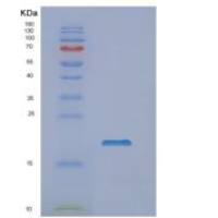 人NUDCD2重组蛋白