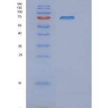 人5'-核苷酸酶Ⅱ(NT5C2)重组蛋白