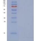 人细胞色素c氧化酶亚单位NDUFA4重组蛋白