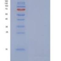 人细胞色素c氧化酶亚单位NDUFA4重组蛋白
