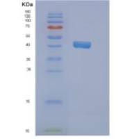 人N-myc下游调节基因2(NDRG2)重组蛋白