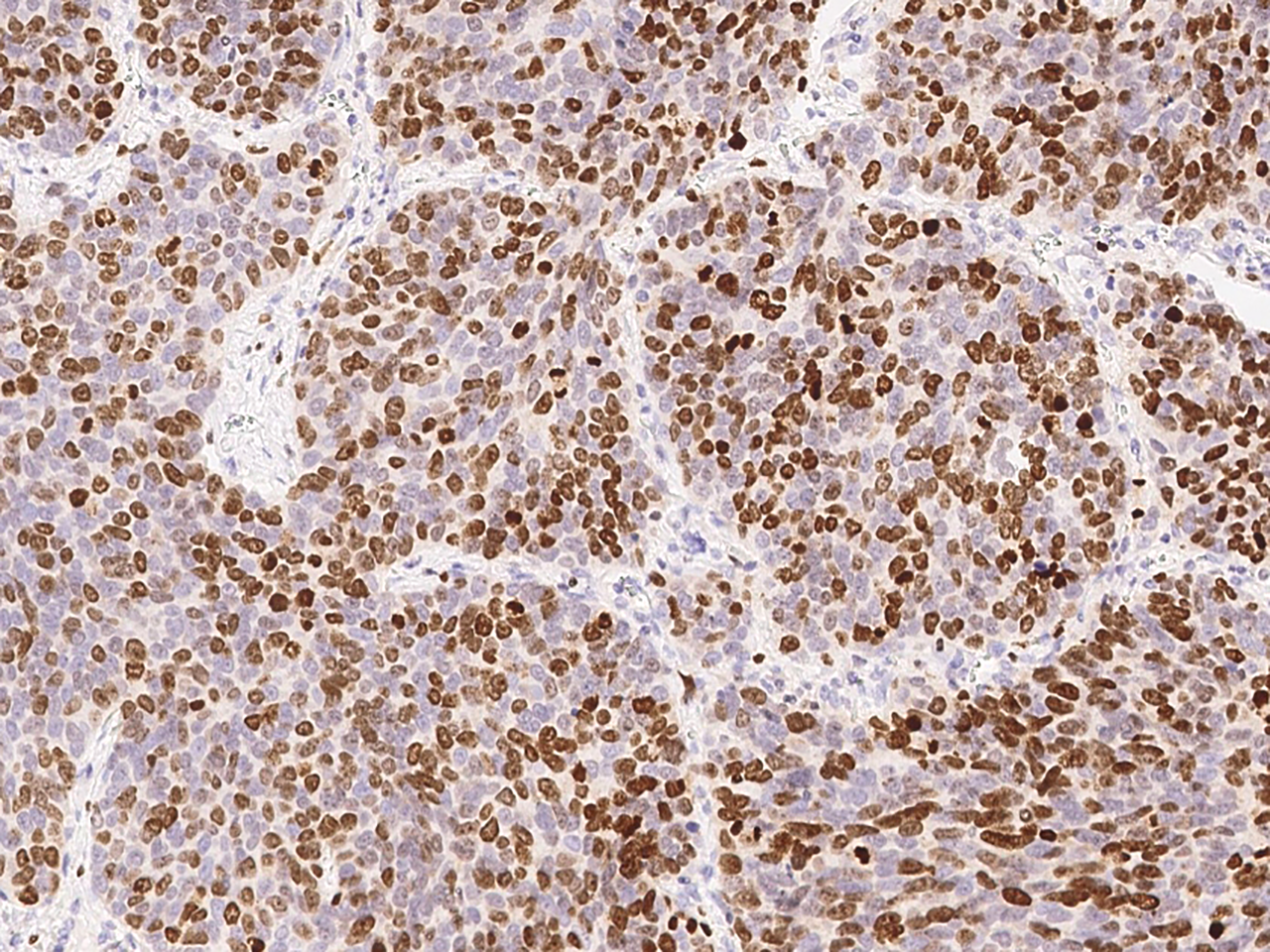 回顾2023年类器官研究进展，分享3D类器官研究解决方案