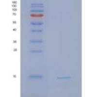人NDFIP1重组蛋白