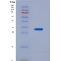 人N-肉豆蔻酰基转移酶2(NMT2)重组蛋白