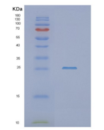 人非同源末端加入因子(NHEJ1)重组蛋白