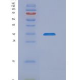 人NIPSNAP1重组蛋白