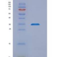 人NIPSNAP1重组蛋白