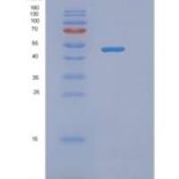 人核小体装配蛋白1样1(NAP1L1)重组蛋白