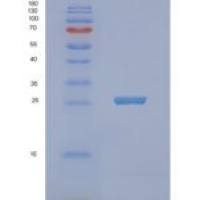 大肠杆菌NFNB重组蛋白