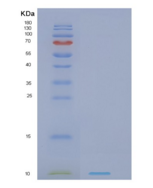 人NDUFV3重组蛋白