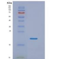 人NANOG同源框蛋白(NANOG)重组蛋白