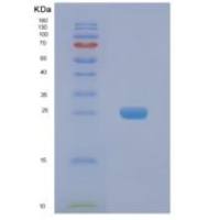 人NAA50重组蛋白