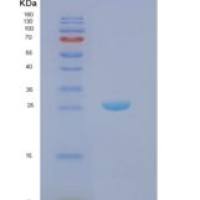 人天然细胞毒性触发受体1（NCR）重组蛋白