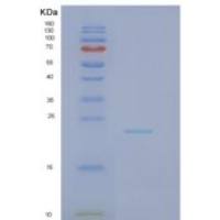 人NOP16重组蛋白