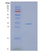 人NSMCE1重组蛋白