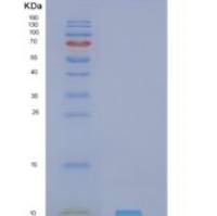 人神经调节素4(NRG4)重组蛋白